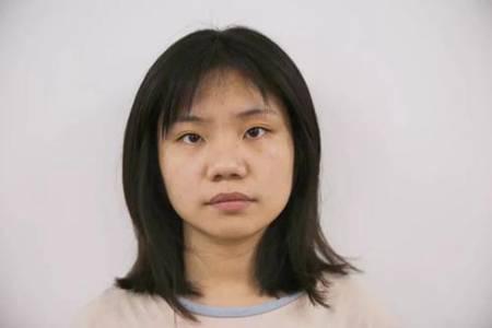 臉色發黃是什么原因，女生面部暗黃小心肝病找上你