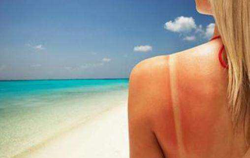 皮膚曬傷后蛻皮怎樣妥善處理 6個妙招幫你快速修復