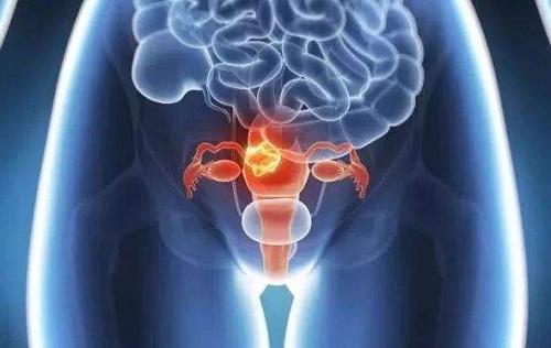 怎樣保養卵巢和子宮?日常注意這些事-易網<a href=http://www.xllyou.com/ target=_blank class=infotextkey>健康養生</a>網 怎樣保養卵巢和子宮?日常注意這些事