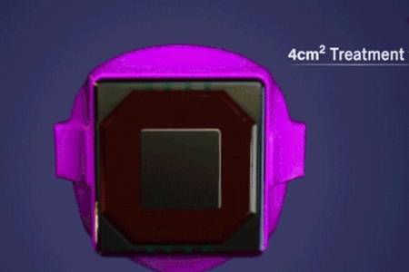 眼部有細紋做1次熱瑪吉 勝過8000斤雅詩蘭黛眼霜