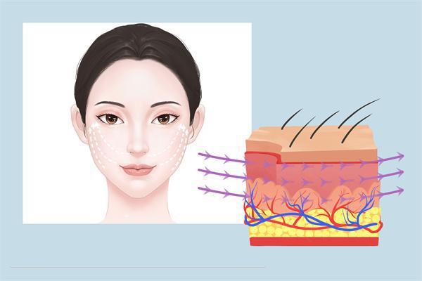 筋膜提升和線雕有什么不一樣-易網健康<a href=http://www.xllyou.com/jkys/ target=_blank class=infotextkey>養生</a>網 筋膜提升和線雕有什么不一樣