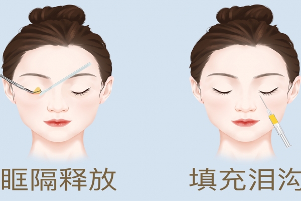 整容都包括哪些項目-易網<a href=http://www.xllyou.com/ target=_blank class=infotextkey>健康養生</a>網 整容都包括哪些項目