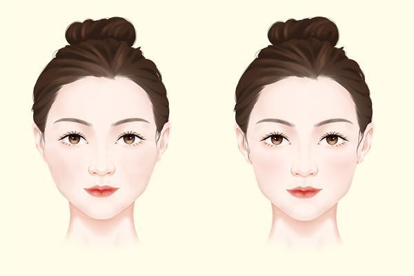 打瘦臉針的注意事項(xiàng)-易網(wǎng)<a href=http://www.xllyou.com/ target=_blank class=infotextkey>健康養(yǎng)生</a>網(wǎng) 打瘦臉針的注意事項(xiàng)