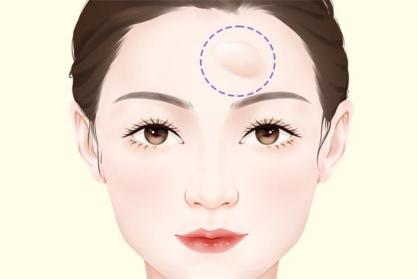 額頭有皺紋怎么回事-易網(wǎng)健康養(yǎng)生網(wǎng) 額頭有皺紋怎么回事