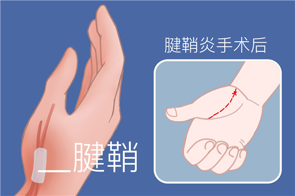 疤痕皮膚修復(fù)方法-易網(wǎng)<a href=http://www.xllyou.com/ target=_blank class=infotextkey>健康養(yǎng)生</a>網(wǎng) 疤痕皮膚修復(fù)方法