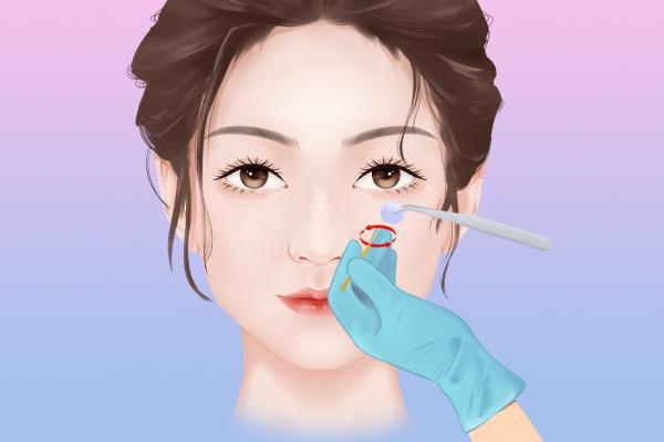 美白針打在哪里-易網<a href=http://www.xllyou.com/ target=_blank class=infotextkey>健康養生</a>網 美白針打在哪里