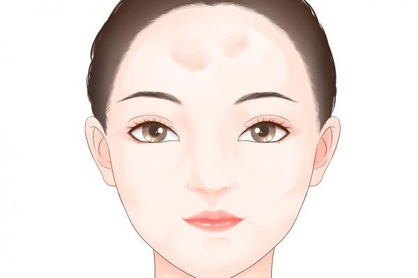 額頭有皺紋怎么回事-易網(wǎng)健康<a href=http://www.xllyou.com/jkys/ target=_blank class=infotextkey>養(yǎng)生</a>網(wǎng) 額頭有皺紋怎么回事