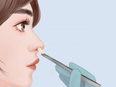 隆鼻手術的風險大嗎