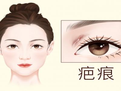 疤痕皮膚修復(fù)方法