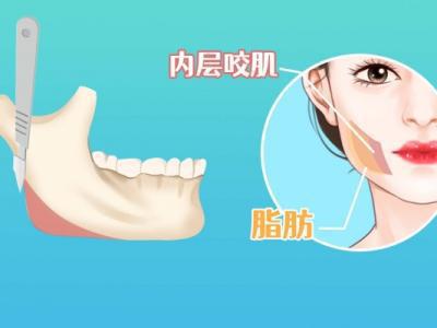 怎樣消除咬肌