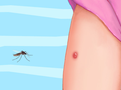 身上很多紅疙瘩、很癢怎么回事