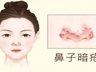 臉色暗沉發(fā)黑怎么才能變白