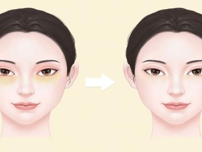 眼袋怎么消除簡單方法