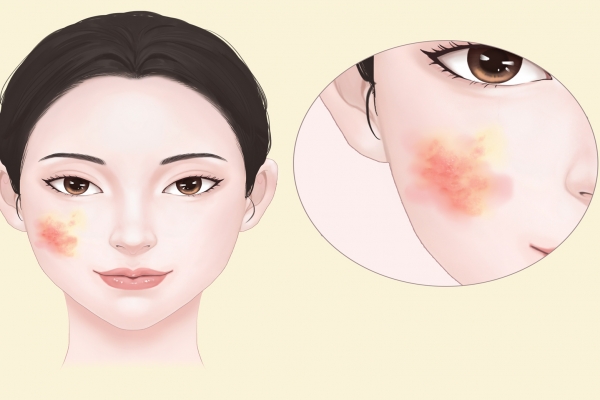 怎樣保養(yǎng)皮膚-易網(wǎng)健康養(yǎng)生網(wǎng) 怎樣保養(yǎng)皮膚