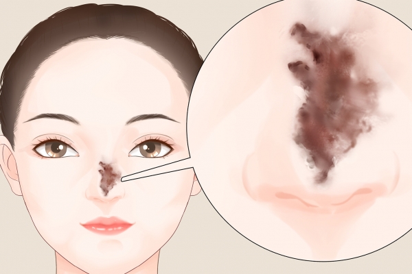 怎樣保養(yǎng)皮膚-易網(wǎng)健康養(yǎng)生網(wǎng) 怎樣保養(yǎng)皮膚