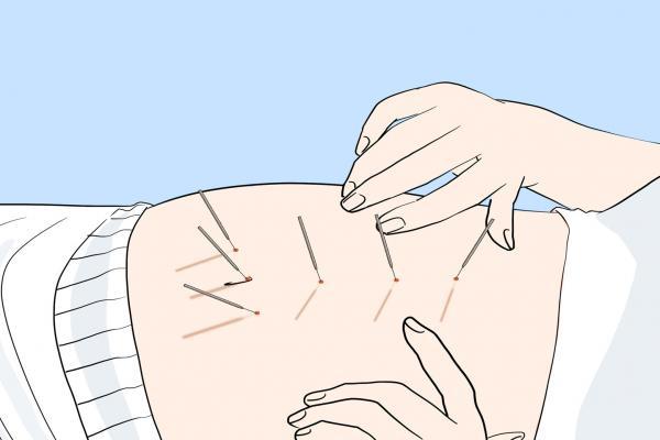 醫(yī)美瘦小腿的方法