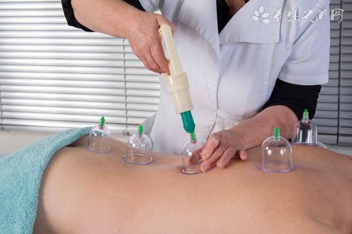 拔罐可以祛濕嗎 拔罐可以祛濕嗎