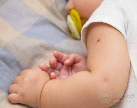 寶寶“秋凍”須把握這4項指標