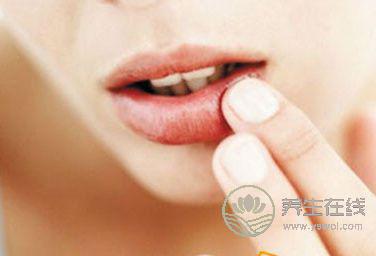 預防秋季爛嘴角的方法有哪些 預防秋季爛嘴角的方法有哪些