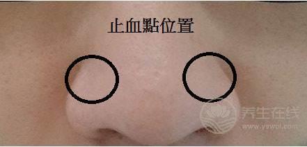 秋季流鼻血更加頻繁,怎樣才能有效止血呢? 秋季流鼻血更加頻繁,怎樣才能有效止血呢?