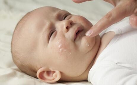 春季如何預防小兒麻疹? 春季如何預防小兒麻疹?