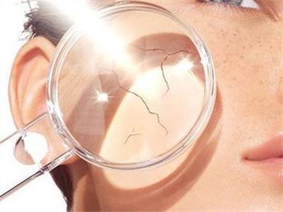 夏季皮膚容易曬傷，試試這八個(gè)急救方法！