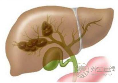 春季養肝，巧用3大護肝秘訣
