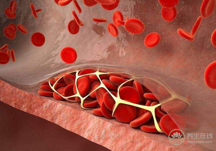 秋季如何預防血栓形成