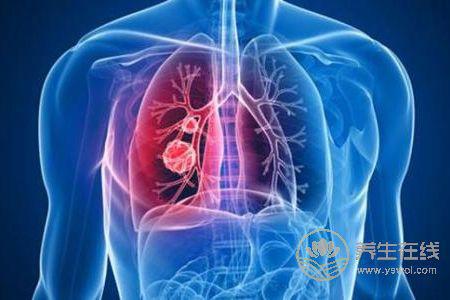 老年人霜降如何養(yǎng)生?老年人霜降如何預防肺炎呢?