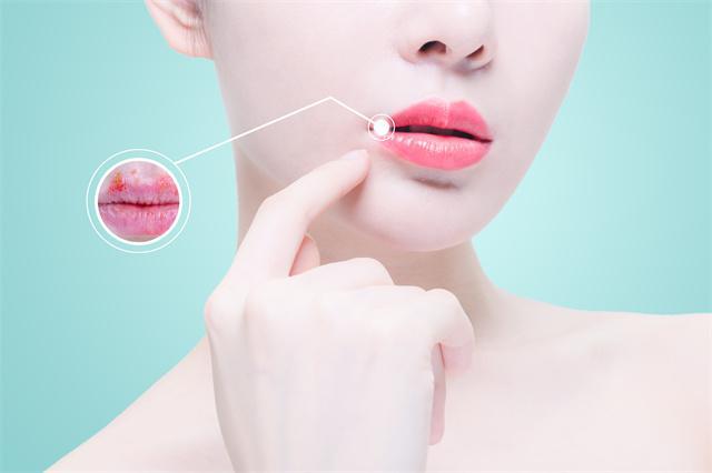 春天嘴唇經常干裂怎么辦?這些妙招幫你緩解-易網<a href=http://www.xllyou.com/ target=_blank class=infotextkey>健康養生</a>網 春天嘴唇經常干裂怎么辦?這些妙招幫你緩解