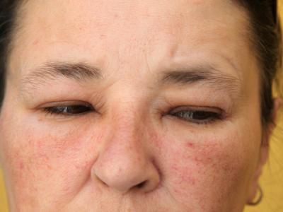 春季過敏，外出踏青要注意哪些問題？