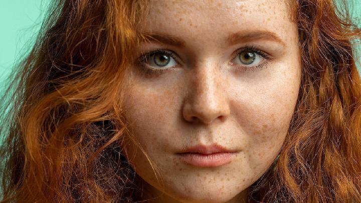 春天花粉過敏怎么治療 7個處理花粉過敏小竅門很有效