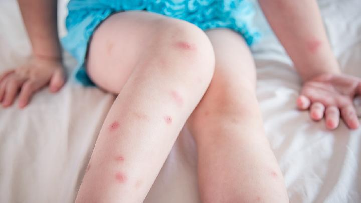 春困應該如何檢查 三種類型春困檢查要留心-易網<a href=http://www.xllyou.com/ target=_blank class=infotextkey>健康養生</a>網 春困應該如何檢查 三種類型春困檢查要留心