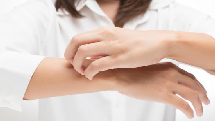 春季花粉過敏食療方有哪些 中醫應對花粉過敏食療方推薦