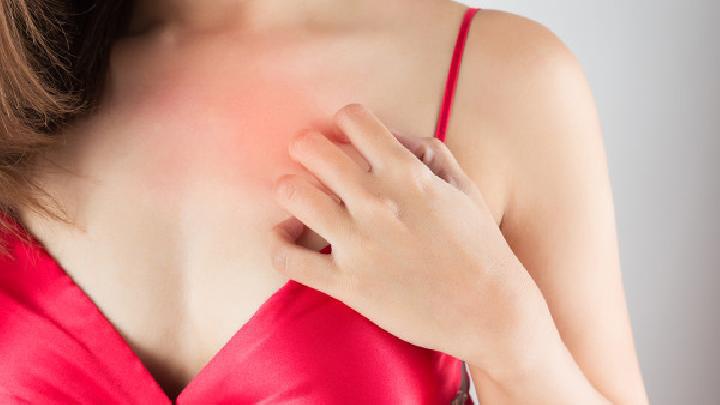 怎么調理花粉過敏體質 花粉過敏主要有三種表現(xiàn)