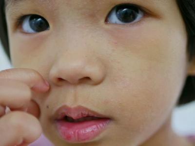 如何判斷自己是否是花粉過敏 判斷花粉過敏從兩方面入手