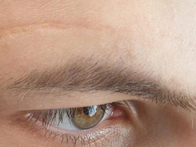 預(yù)防春季過敏的方法有哪些 春季過敏存在5大原因