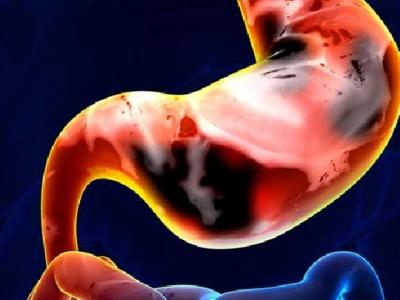 生活中養胃的方法有哪些 7個最佳時間段養胃護胃更有效