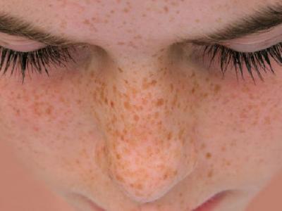 春季養(yǎng)生注意什么事項(xiàng) 春季養(yǎng)生注意防曬溫水洗臉