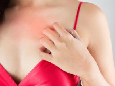 怎么調(diào)理花粉過敏體質(zhì) 花粉過敏主要有三種表現(xiàn)