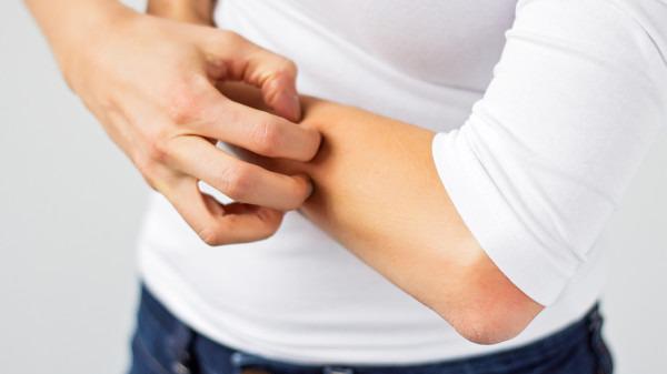 冬天皮膚瘙癢是血燥？ 需要內(nèi)外調(diào)理