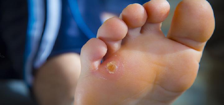 冬季什么時候適合泡腳 冬天泡腳需要注意些什么