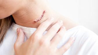 冬天手心出汗？6個(gè)情況要知曉