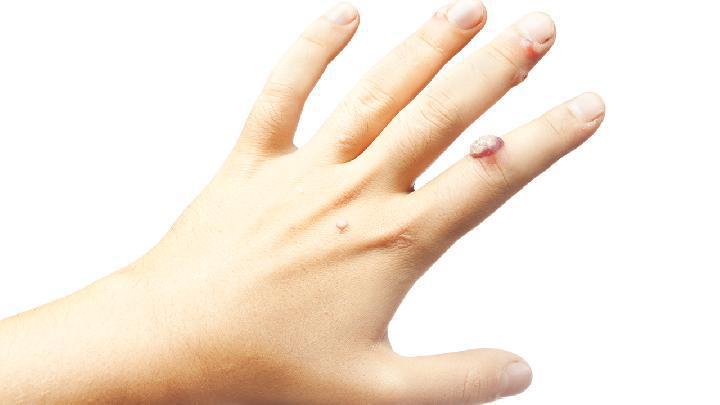 夏季怎么保養(yǎng)皮膚？夏天保護(hù)皮膚的方法有什么