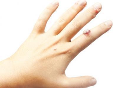 夏季怎么保養(yǎng)皮膚？夏天保護皮膚的方法有什么