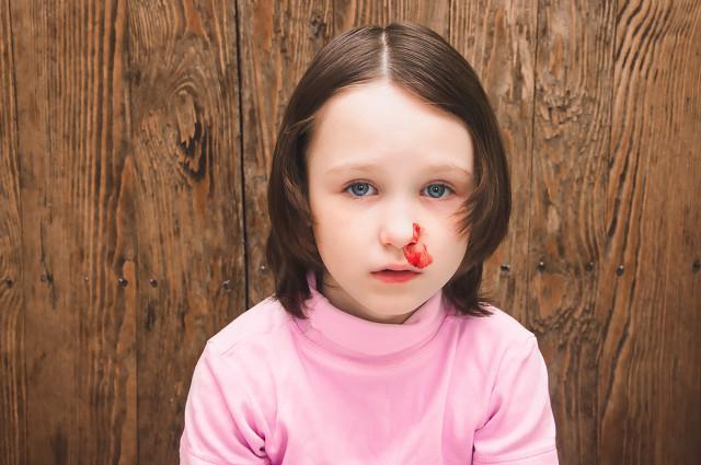 秋季干燥總是容易流鼻血，秋季如何預防流鼻血？