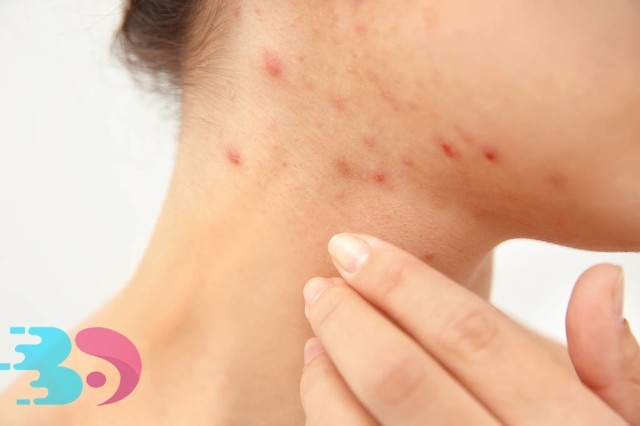 水土不服過(guò)敏多久能好,原來(lái)它還和身體素質(zhì)有關(guān)!-易網(wǎng)健康養(yǎng)生網(wǎng) 水土不服過(guò)敏多久能好,原來(lái)它還和身體素質(zhì)有關(guān)!