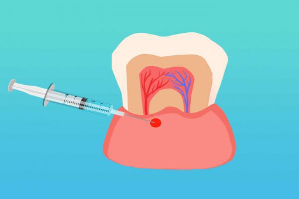 秋季上火牙疼怎么辦