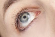 倒春寒 需謹防三種眼病