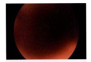 視力快速下降的原因有這么多，你知道嗎？